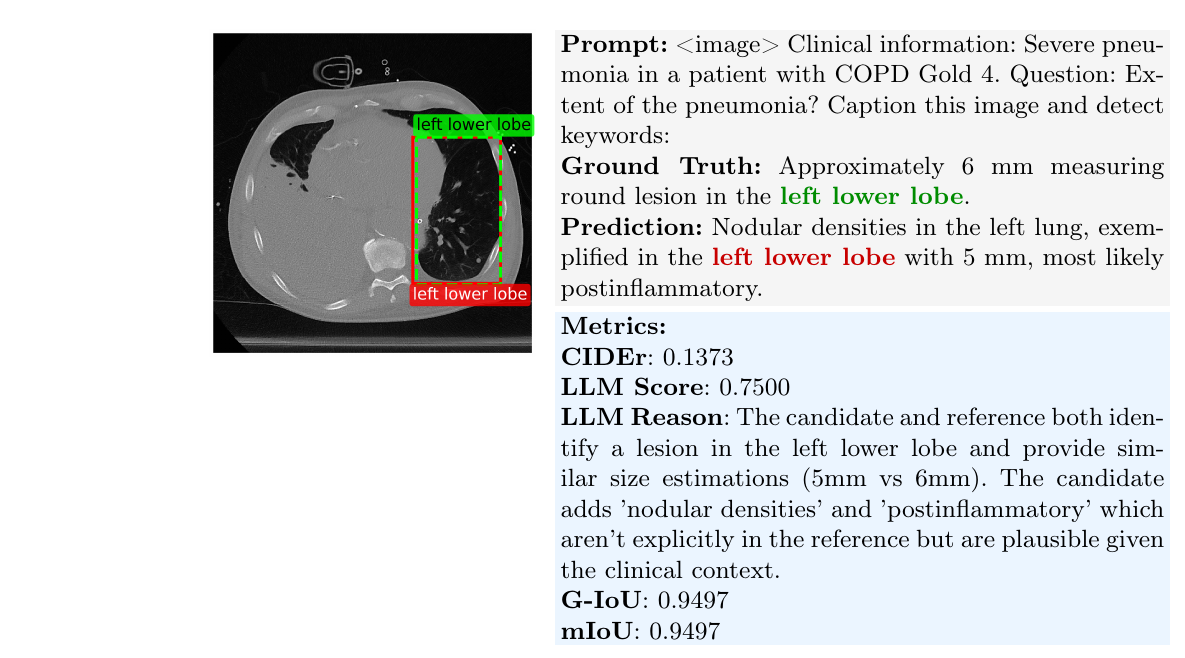 Detection grounding example: RadGrounder localizes a nodular lesion in the left lower lobe on a chest CT